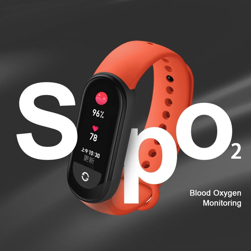 Smartwatch Xiaomi Mi Band 6 NFC